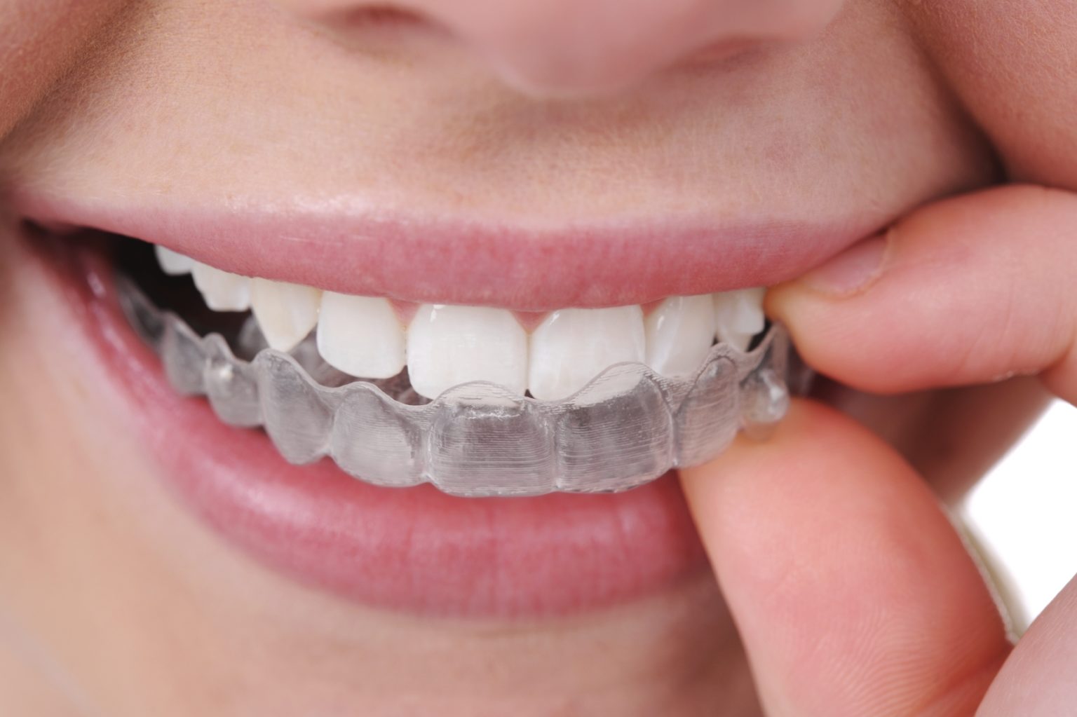 Choose the Best Orthodontist for Your Smile